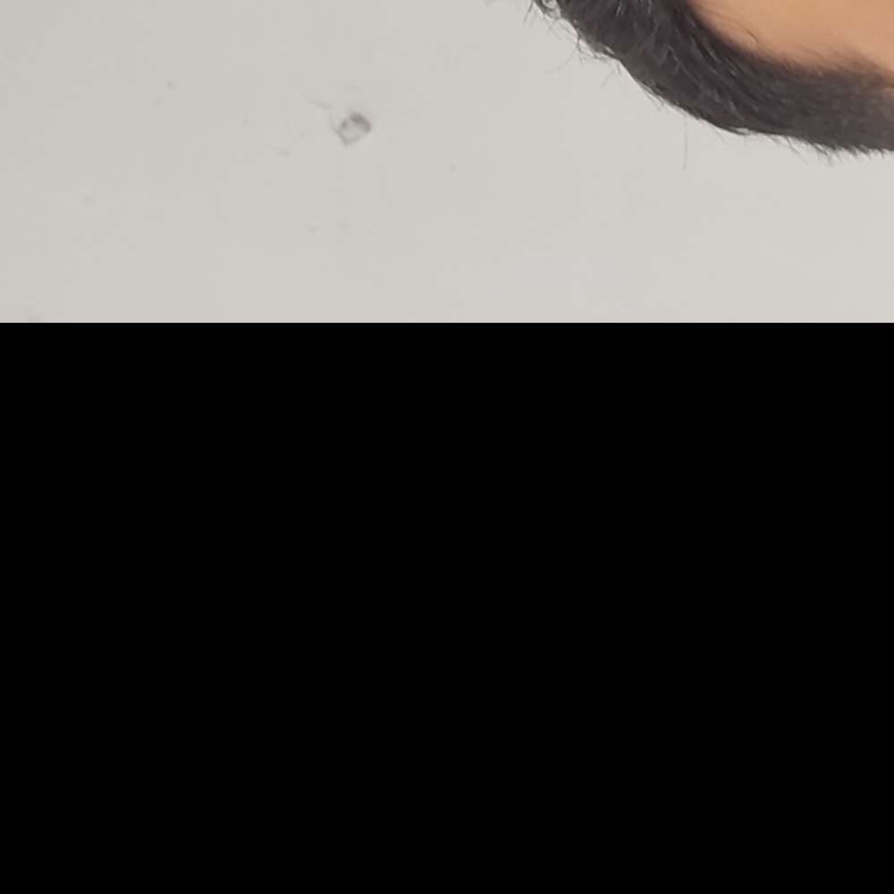 صنعان ساعدموچشی